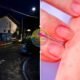 Split image showing a dark urban street at night on the left and a close up of a hand placing a white swab near a persons mouth on the right